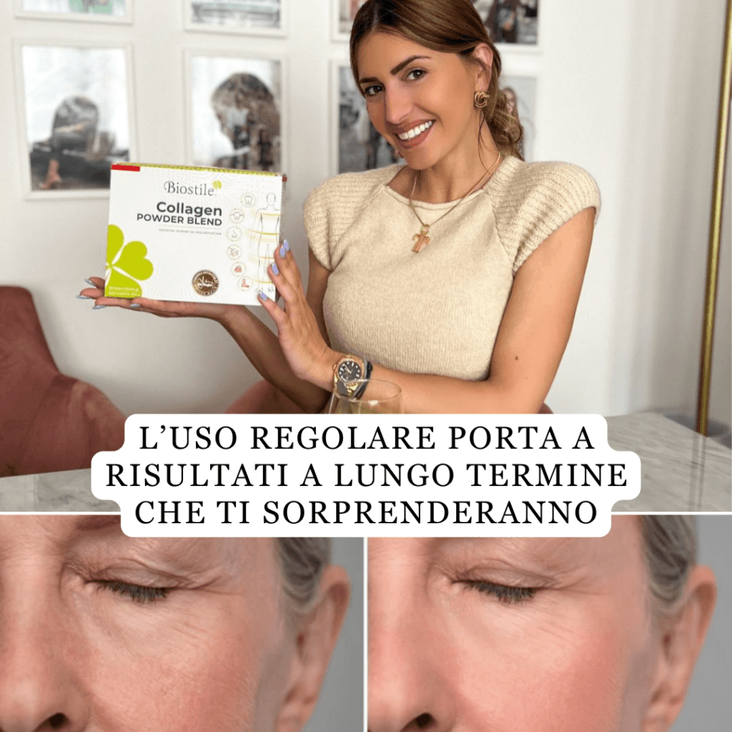 brand collagen s hialuronsko kislino darilo shaker mladosten videz lp 1