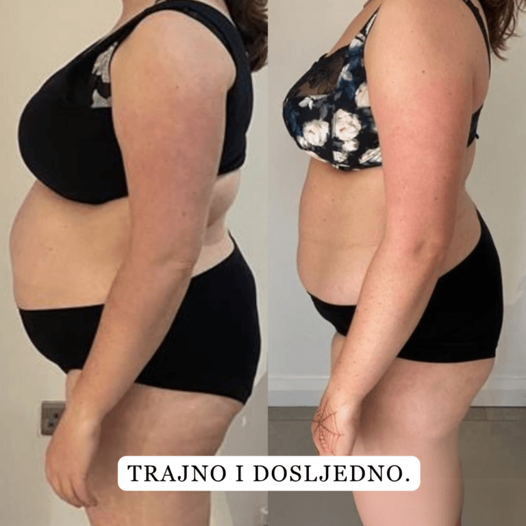 brand slimis bonboni za hujsanje lp 1 safe